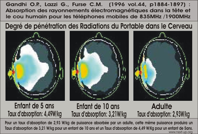 15%20720%20netration_irradiation_tm_cerveau_next_up%20650%20.png