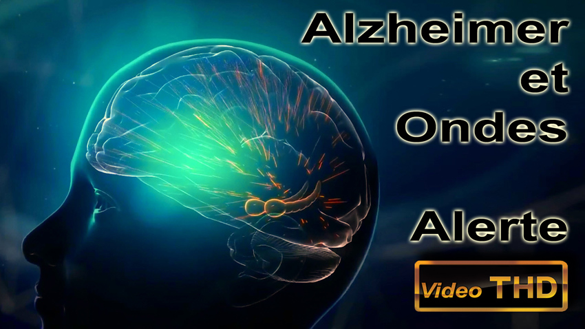 Alzheimer_et_ondes_850.jpg