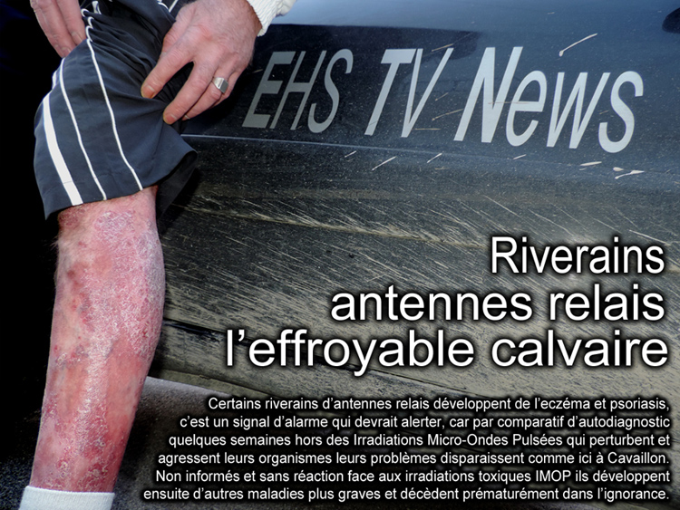 Antennes_relais_riverains_eczema_et_psoriasis_alerte_750_DSCN3987.jpg