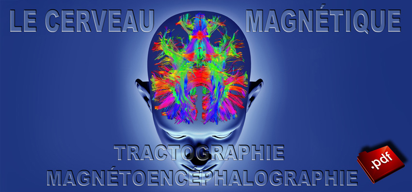 CM_Cerveau_Magnetique_Tractographie_MagnetoEncephaloGraphie_850.jpg