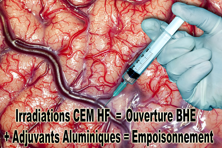 Cerveau_Adjuvants_Aluminiques_et_CEM_et_BHE_egale_Empoisonnement_750.jpg