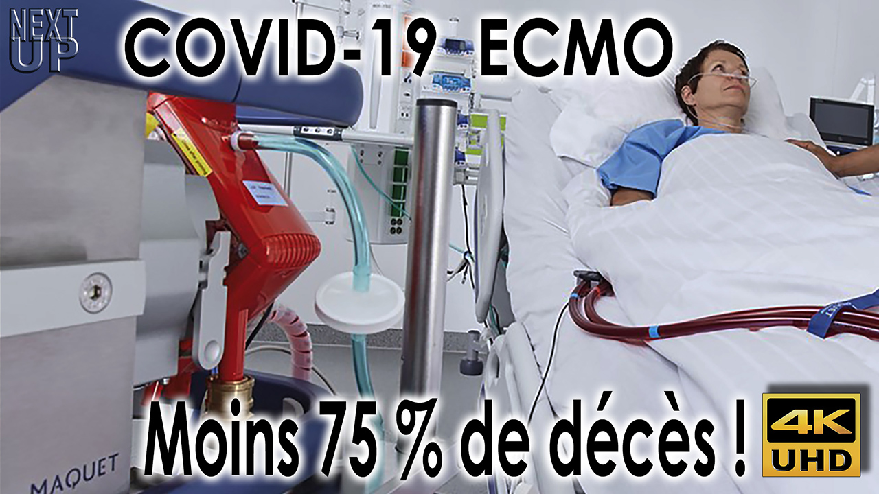 Covid_19_ECMO_1280.jpg