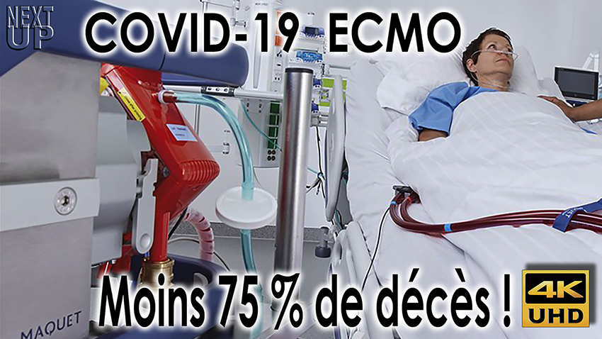 Covid_19_ECMO_850.jpg