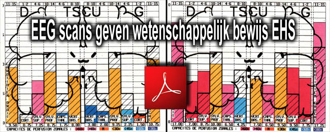 EEG_scans_geven_wetenschappelijk_bewijs_EHS_Franse_09_09_2010_news