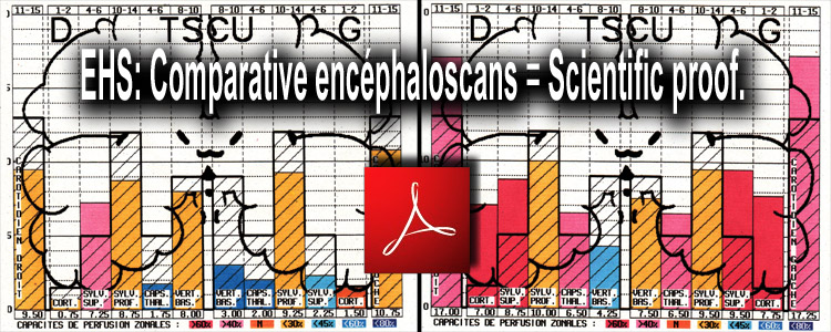 EHS_comparative_encephaloscans_scientific_proof