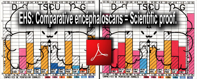 EHS_comparative_encephaloscans_scientific_proof_28_08_2010_news_650