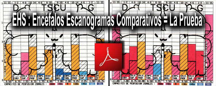 EHS_encefalos_escanogramas_comparativos_23_08_2010