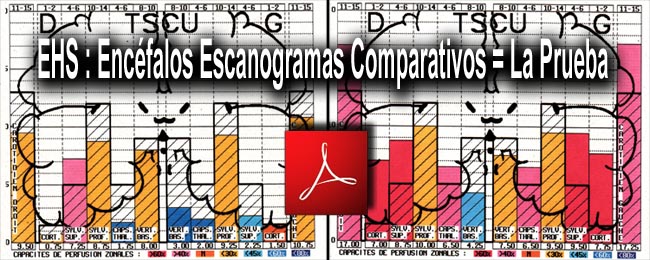 EHS_encefalos_escanogramas_comparativos_23_08_2010_news_650