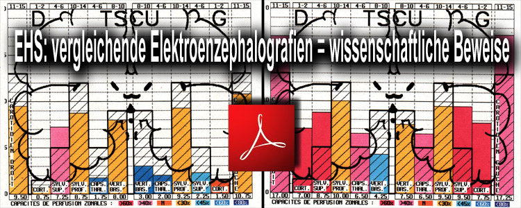 EHS_vergleichende_Elektroenzephalografien_wissenschaftliche_Beweise_26_09_2010