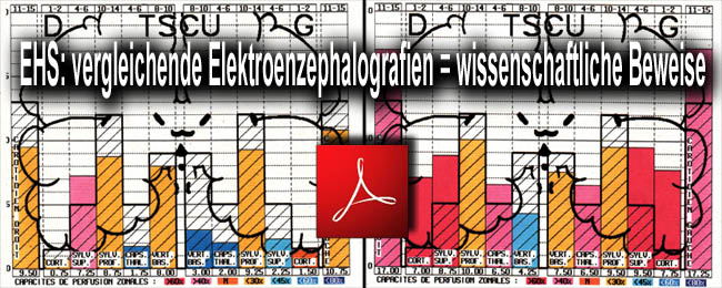 EHS_vergleichende_Elektroenzephalografien_wissenschaftliche_Beweise_26_09_2010_news