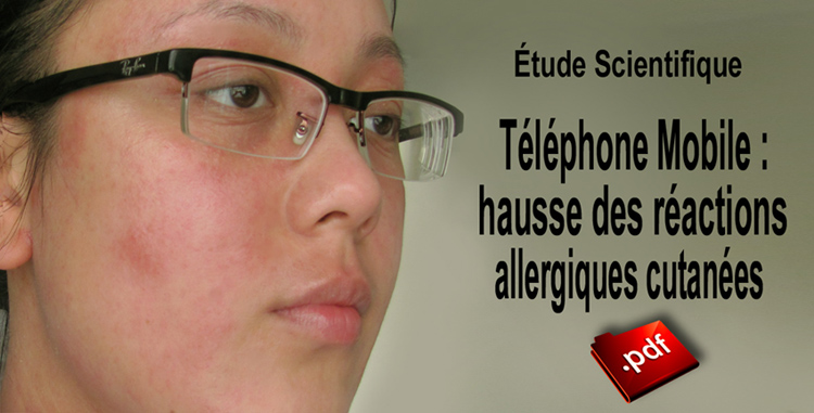 Etude_scientifique_hausse_des_reactions_allergiques_cutanees_flyer_750_02_06_2014.jpg