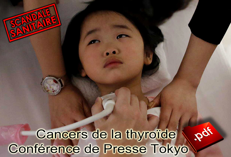 Fukushima_Scandale_sanitaire_cancers_thyroide_750.jpg