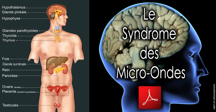 Le_Syndrome_des_Micro_Ondes_version_02_2013_copie