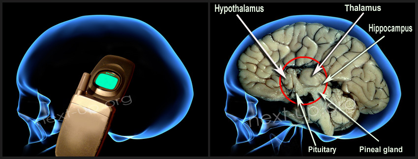 Mobile_phone_and_brain