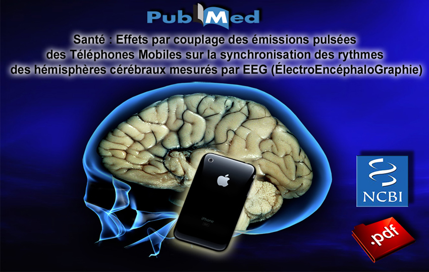 NCBI_Effets_par_couplage_emissions_pulsees_Telephones_Mobiles_sur_la_synchronisation_des_rythmes_cerebraux_mesures_par_EEG_850.jpg