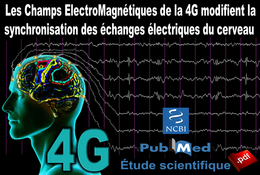 NCBI_Exposition_CEM_4G_LTE_modifie_la_synchronisation_de_l_activation_des_echanges_electriques_EEG_de_tout_le_cerveau_2015_850.jpg