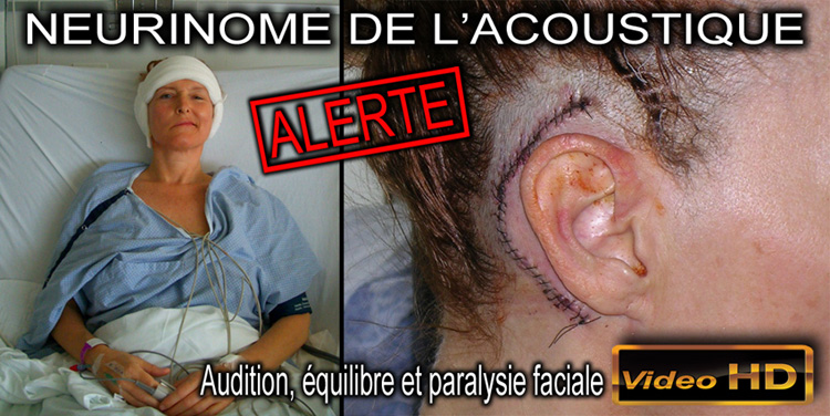 Neurinome_de_l_acoustique_flyer_duo_750.jpg