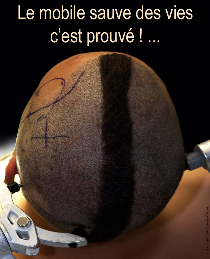 Posters_Le_mobile_sauve_des_vie_c_est_prouve_preparation_operation_trepanation_680