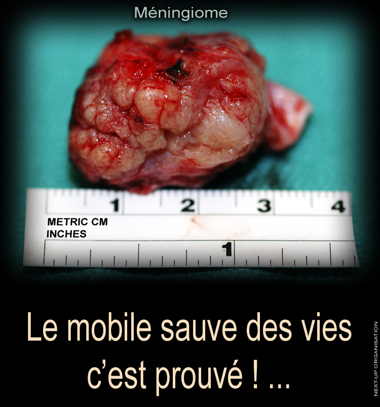 Posters_Sensibilisation_Le_Mobile_sauve_des_vies_c_est_prouve_Meningiome_750