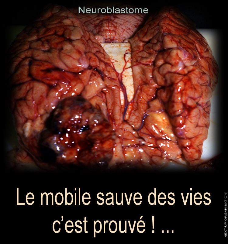 Posters_Sensibilisation_Le_Mobile_sauve_des_vies_c_est_prouve_Neuroblastome_750