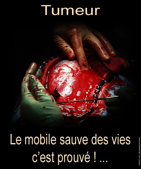 Posters_Sensibilisation_Le_Mobile_sauve_des_vies_c_est_prouve_Tumeur_450_541