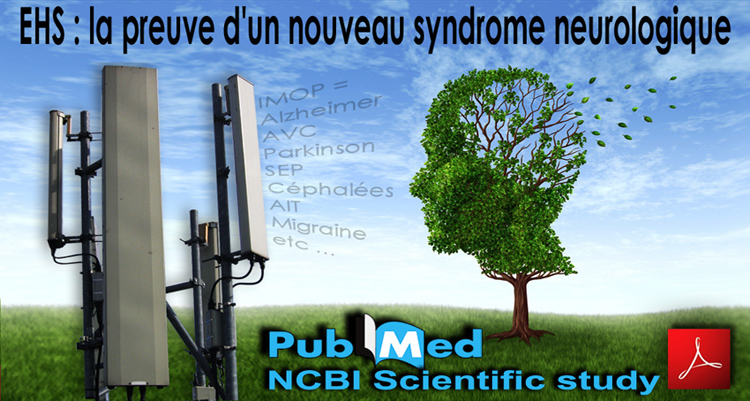 Radiation_CEM_Syndrome_Neurologique_NCBI_Etude_Scientifique_750