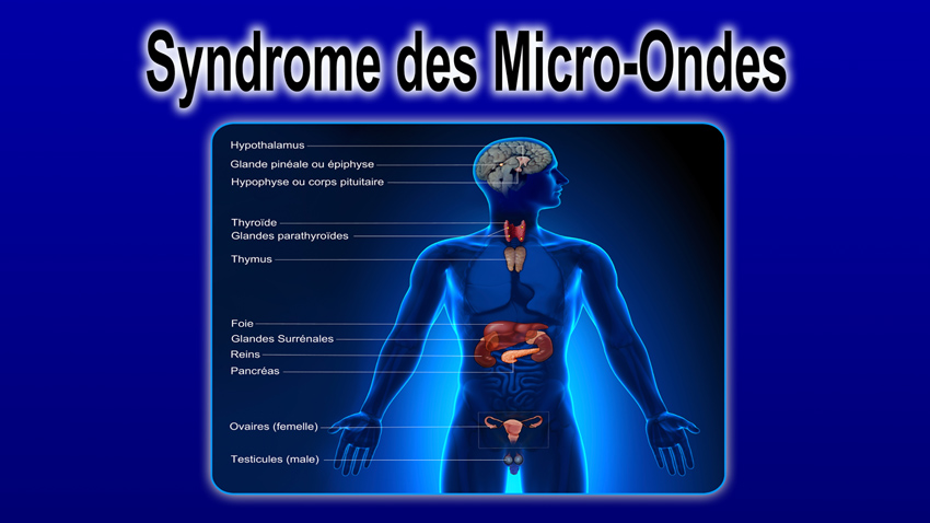 Syndrome_Micro_ondes_recto_News_850.jpg