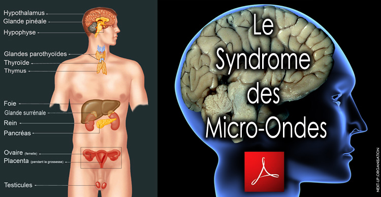 Syndrome_des_Micro_Ondes.png