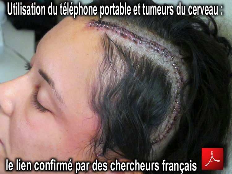 Utilisation_du_telephone_portable_et_tumeurs_du_cerveau_le_lien_confirme_par_des_chercheurs_francais_750_14_05_2014.jpg