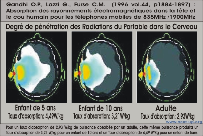 http://www.next-up.org/images/imagerie_irradiation_cerveau_portable.jpg